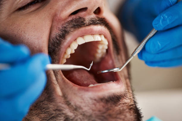 Best Broken Tooth Emergency  in Lake Ozark, MO